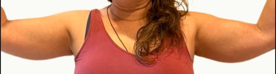 one treatment session 3 after